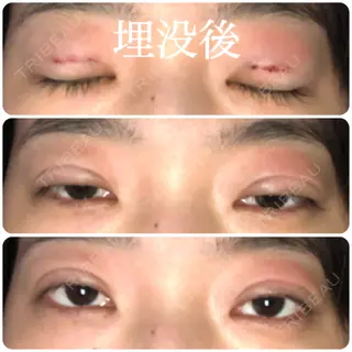 0日目の経過画像（1枚目）