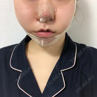 1日目の経過画像（1枚目）