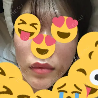 2日目の経過画像（3枚目）