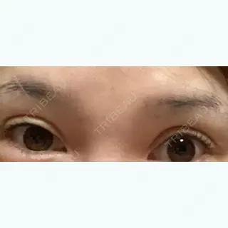 394日目の経過画像（1枚目）