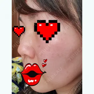 3日目の経過画像（3枚目）
