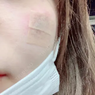0日目の経過画像（1枚目）