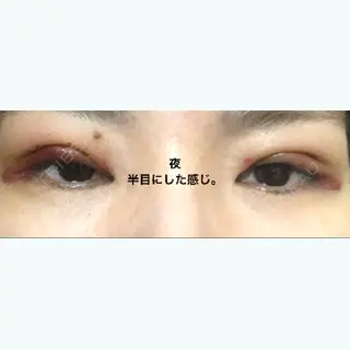 1日目の経過画像（2枚目）