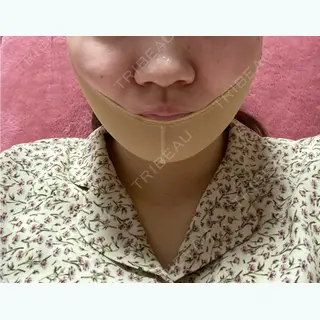 2日目の経過画像（1枚目）