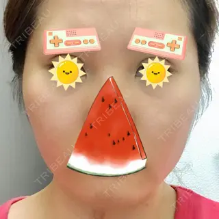 1日目の経過画像（1枚目）