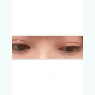 7日目の経過画像（2枚目）