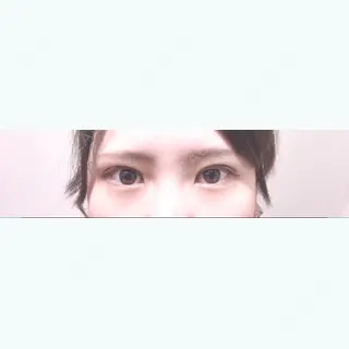 4日目の経過画像（1枚目）