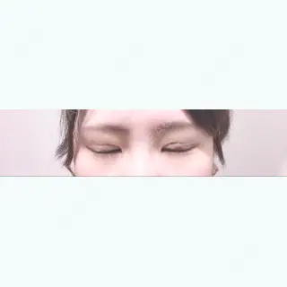 4日目の経過画像（2枚目）