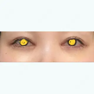 8日目の経過画像（2枚目）