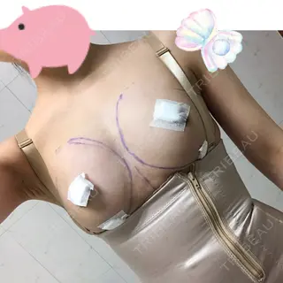 0日目の経過画像（1枚目）