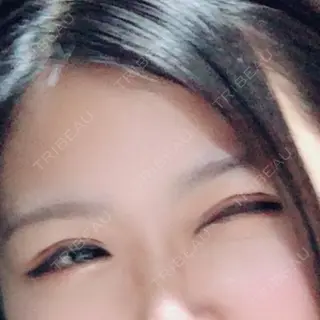 3日目の経過画像（2枚目）