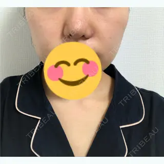 7日目の経過画像（1枚目）