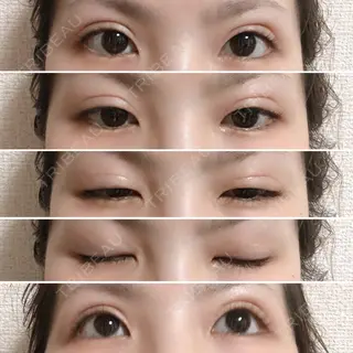 7日目の経過画像（1枚目）