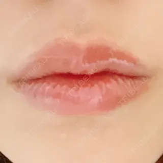 0日目の経過画像（1枚目）