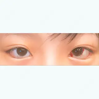 8日目の経過画像（1枚目）
