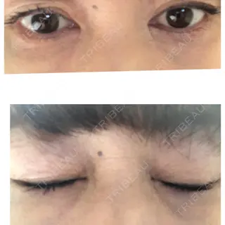 4日目の経過画像（2枚目）