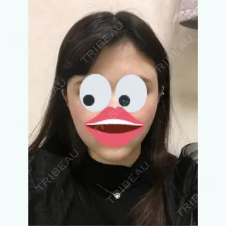 38日目の経過画像（1枚目）