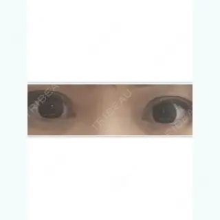 9日目の経過画像（1枚目）