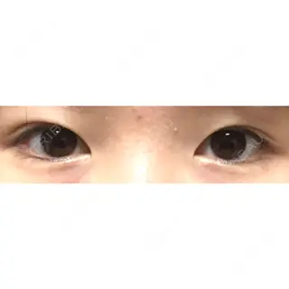 9日目の経過画像（1枚目）