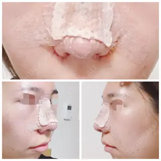 1日目の経過画像（1枚目）