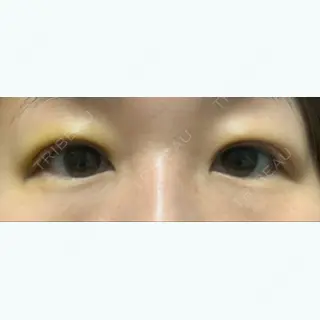 8日目の経過画像（1枚目）