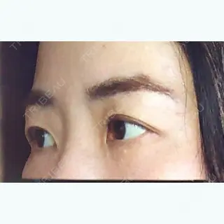 19日目の経過画像（2枚目）