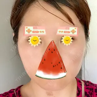 4日目の経過画像（1枚目）