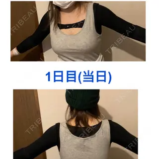 0日目の経過画像（1枚目）