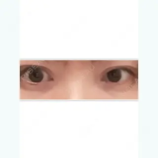 12日目の経過画像（1枚目）
