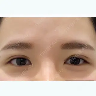 0日目の経過画像（1枚目）