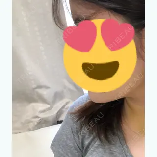 7日目の経過画像（2枚目）