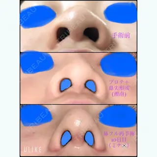 10日目の経過画像（2枚目）