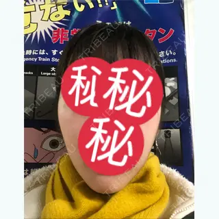 21日目の経過画像（1枚目）