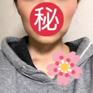 10日目の経過画像（1枚目）
