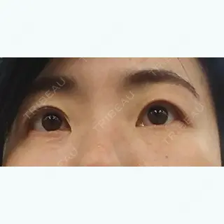 21日目の経過画像（1枚目）