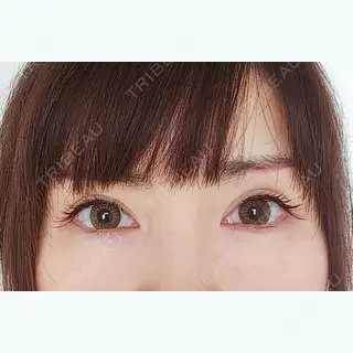 22日目の経過画像（1枚目）