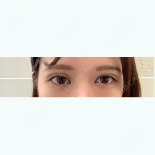 12日目の経過画像（1枚目）