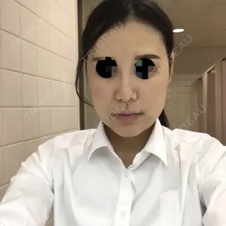 11日目の経過画像（1枚目）