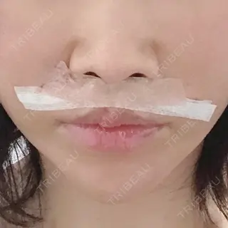 1日目の経過画像（1枚目）