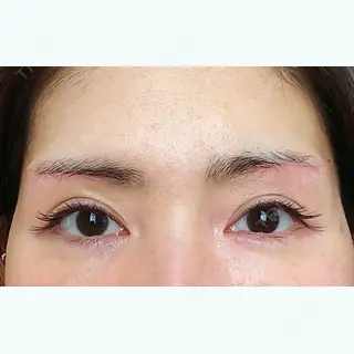 23日目の経過画像（1枚目）