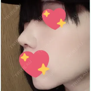 9日目の経過画像（2枚目）