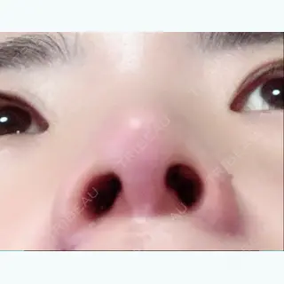 9日目の経過画像（3枚目）