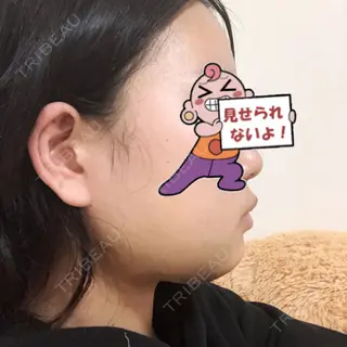 3日目の経過画像（1枚目）