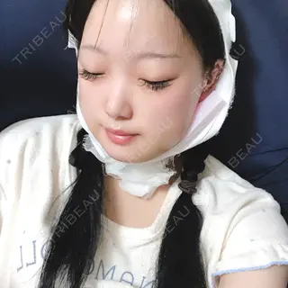 3日目の経過画像（3枚目）