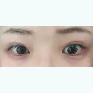 10日目の経過画像（1枚目）