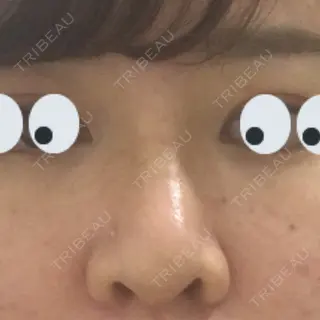 9日目の経過画像（1枚目）