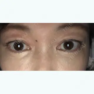10日目の経過画像（2枚目）
