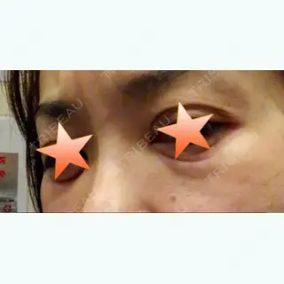 0日目の経過画像（3枚目）