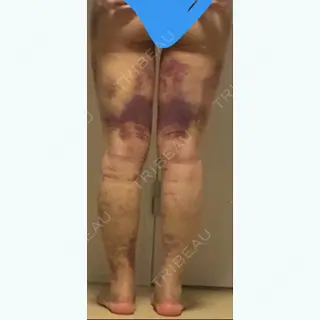 9日目の経過画像（2枚目）