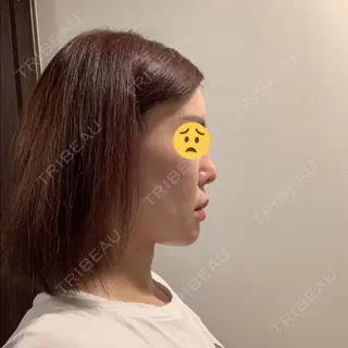 12日目の経過画像（2枚目）